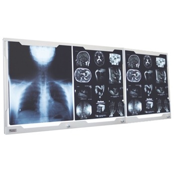 Equipamentos Radiologia - Negatoscpios LED - Negatoscpio 3 Corpos Led Konex de Parede